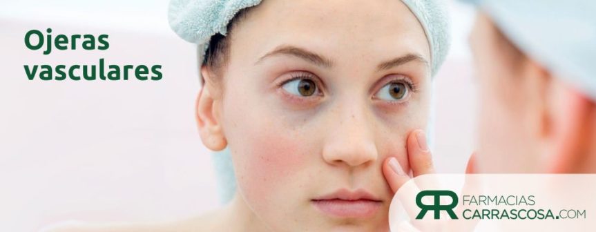 Ojeras vasculares: por qué salen y tratamiento cosmético